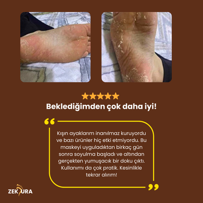 Zekura™ Ayak Peeling Maskesi